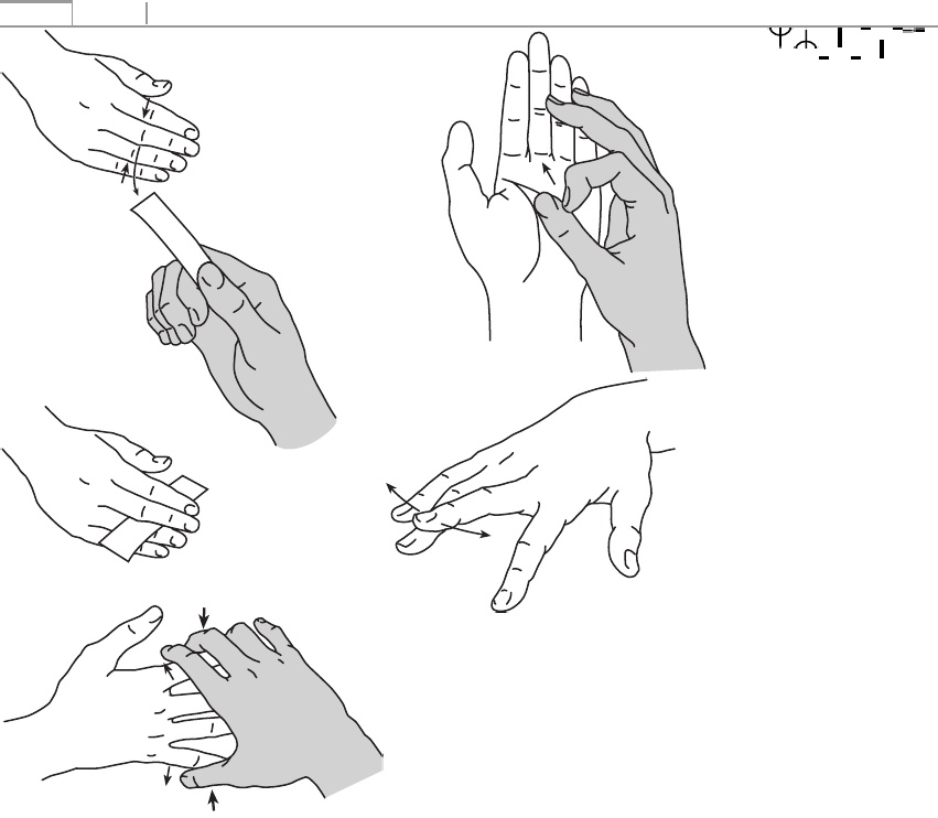 A kéz Artroszusa